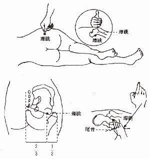 還跳穴|每日一穴位——環跳穴（治療腰痛、背痛、半身不遂）